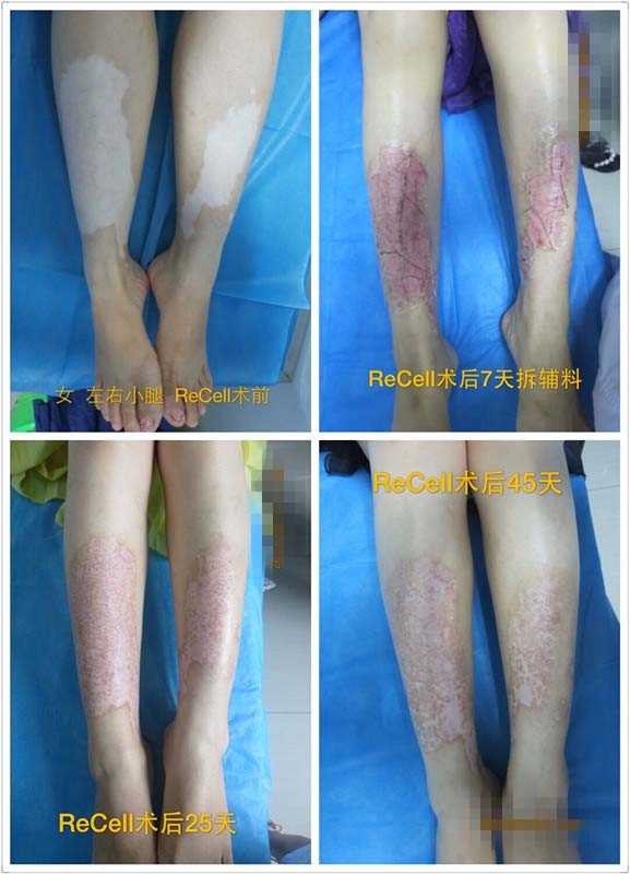 4-1P52F92406363_���� ����.jpg