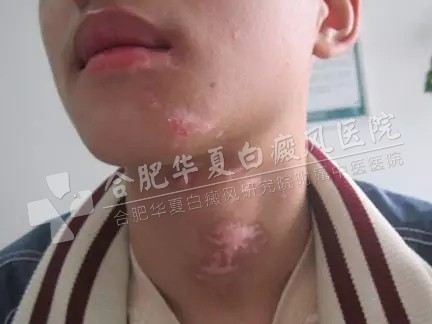 sdf阿萨德.jpg sdf阿萨德.jpg