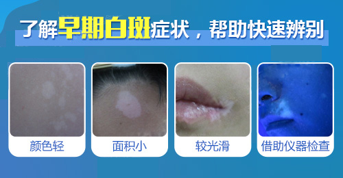 早期白斑症状